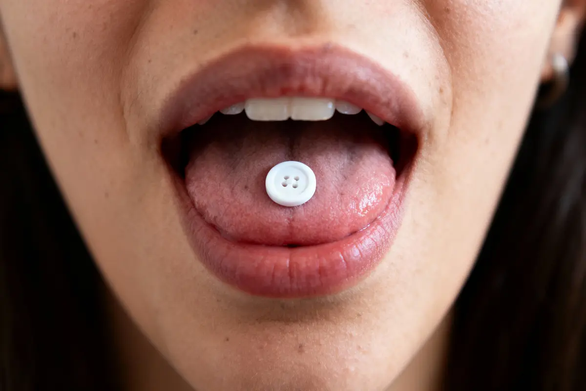 Personne avec un bouton blanc posé sur la langue, bouche ouverte, gros plan.