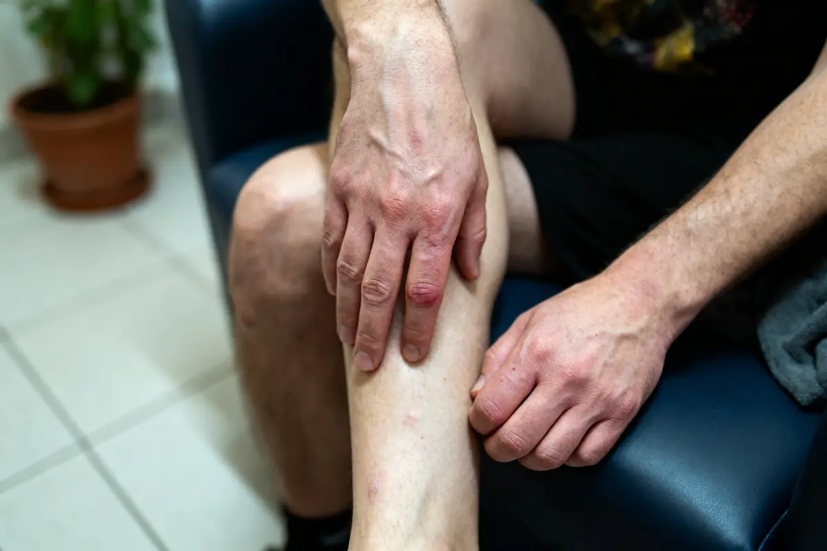 Un homme assis touche sa jambe, posée sur une chaise bleue, lumière intérieure.