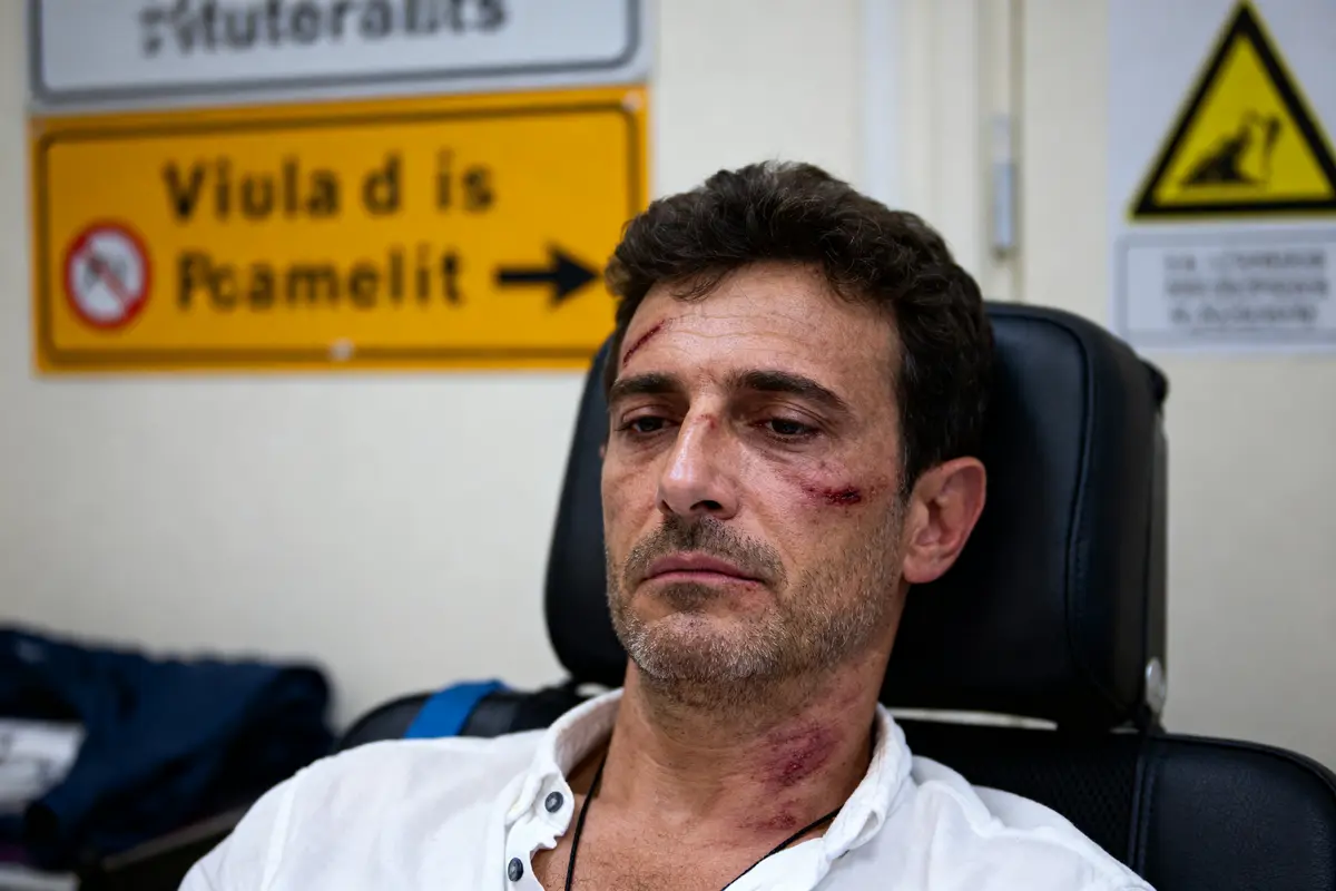 Un homme blessé, assis sur une chaise médicale, avec des blessures visibles au visage.